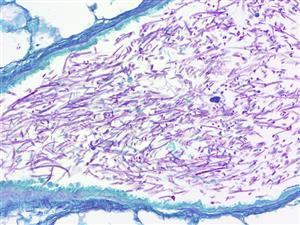 4232A | Control Slides:Histopathology; Fungus, PAS, Aspergillus sp., Artificial